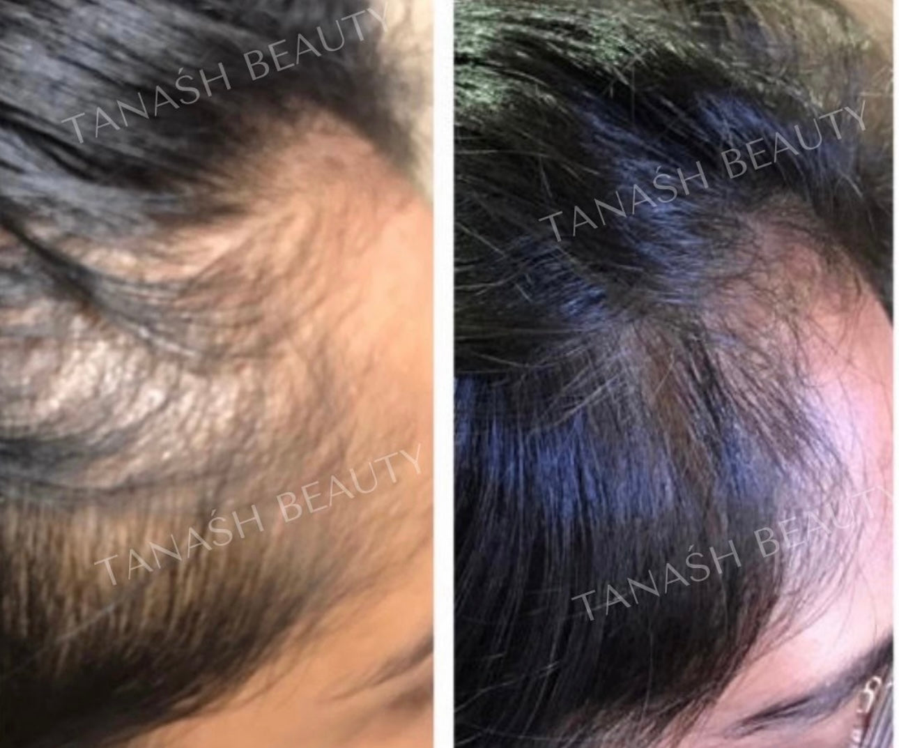 Intense Growth Oil Treatment