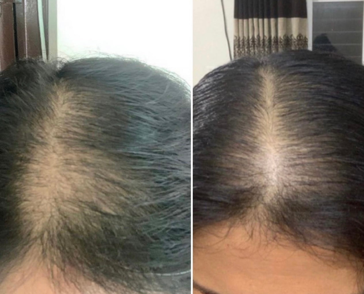 Intense Growth Oil Treatment